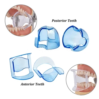 20pcs Dantų Ortodontinis Lūpos, Skruosto Susitraukimo Burną Atidarytuvas Žodžiu Expander Priekinių Dantų Krūminių Dantų Odontologas Įrankis